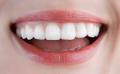 Металлокерамика зубов от стоматологической клиники "Город"