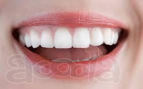 Металлокерамика зубов от стоматологической клиники "Город"